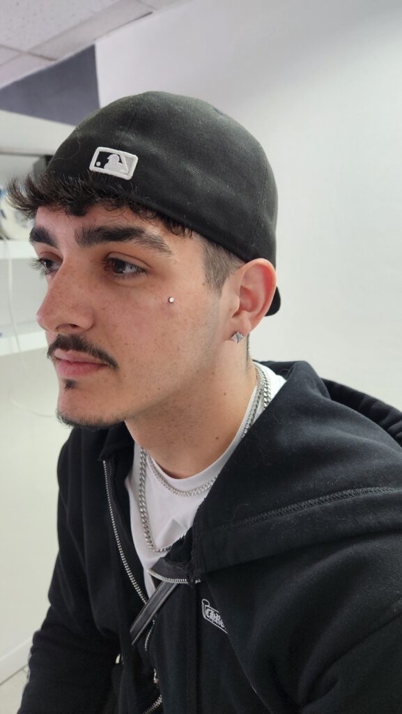 Cheek dermals piercing by Gabi at Hypnotic Art Tattoo Studio, Milton Keynes